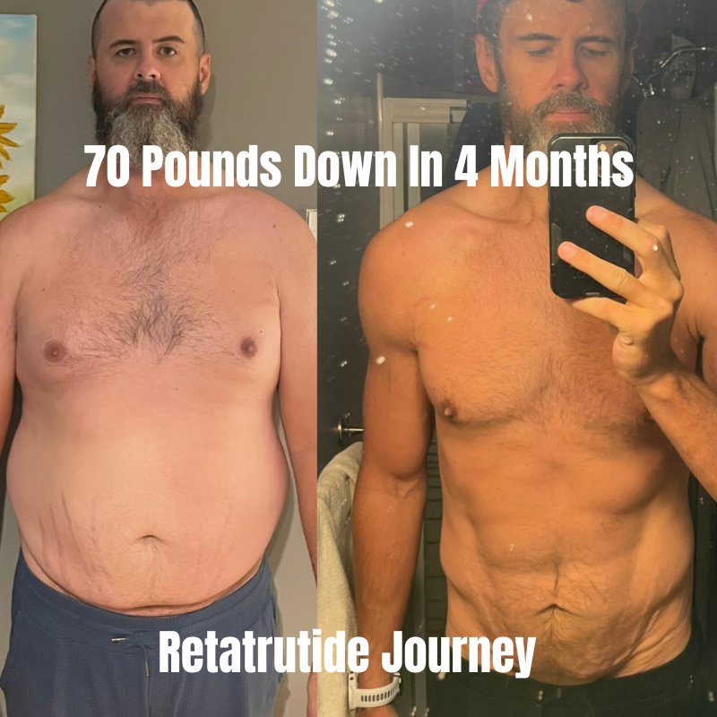 Retatrutide before and after - 90 pounds lost in 8 months