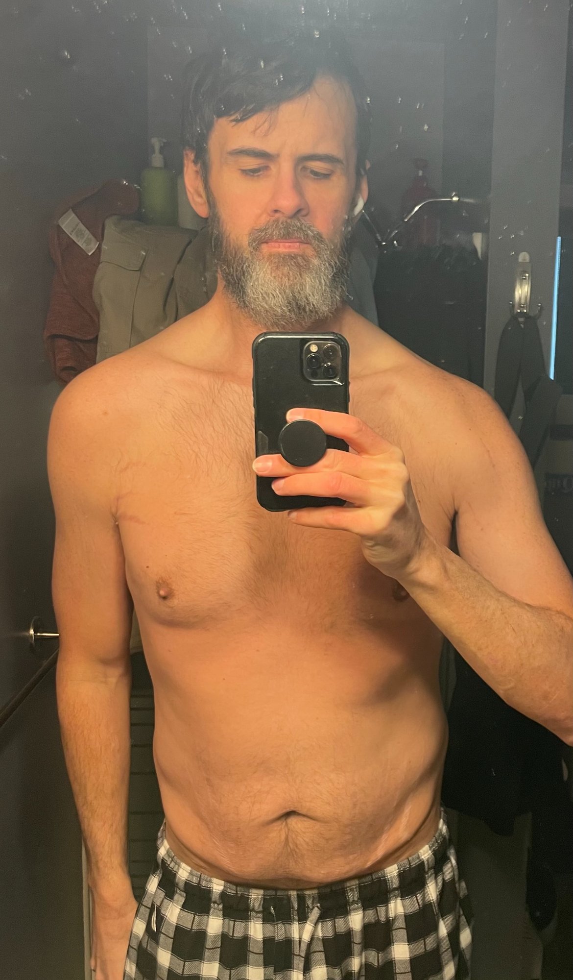 March 5, 2026 - most recent progress photo